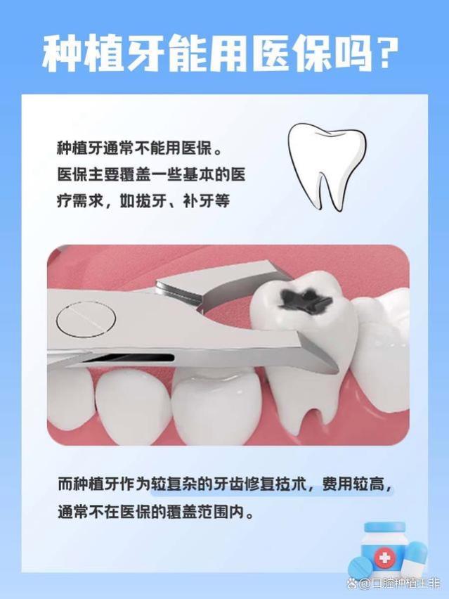 种植牙可以用医保吗